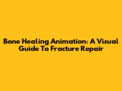 Bone Healing Animation: A Visual Guide To Fracture Repair