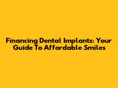 Financing Dental Implants: Your Guide To Affordable Smiles